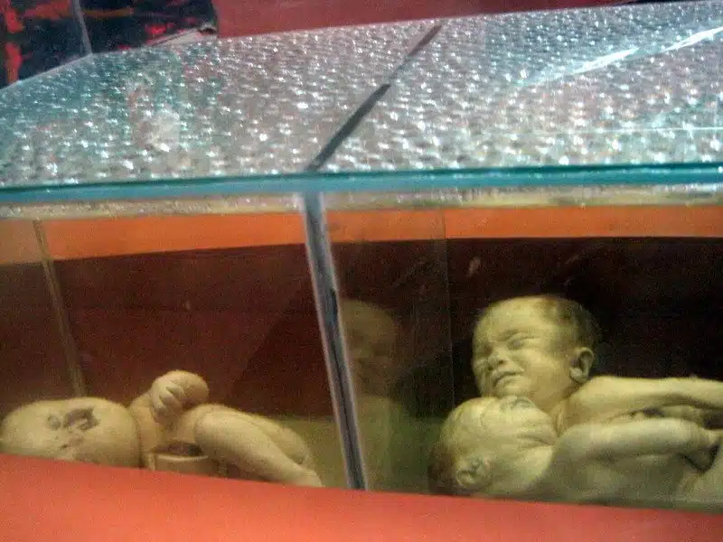 Heartbreaking display about the effects of the war on babies.
