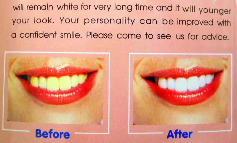A dental tourism pamphlet in Thailand.